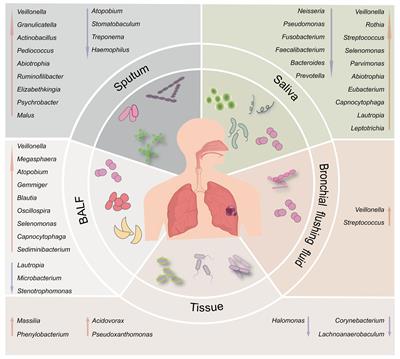 Symbiotic microbial communities in various locations of the lung cancer respiratory tract along with potential host immunological processes affected